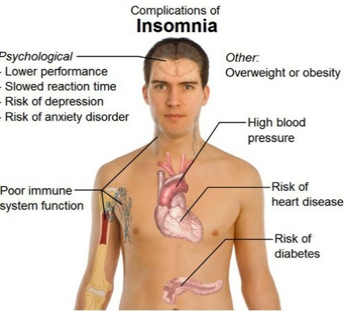 The effects of sleep deprivation The effects of sleep deprivation